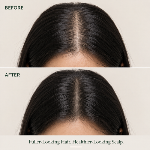 SCALP REVIVAL BAR