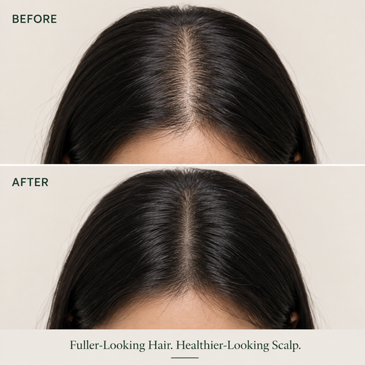 SCALP REVIVAL BAR