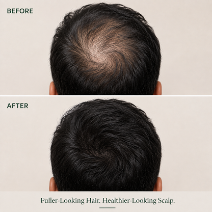 Korean Hair Growth Bar
