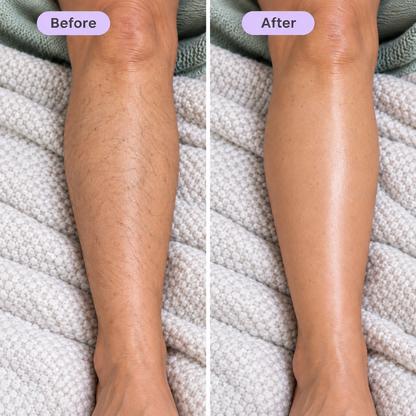 Balmo Hair Removal Cream