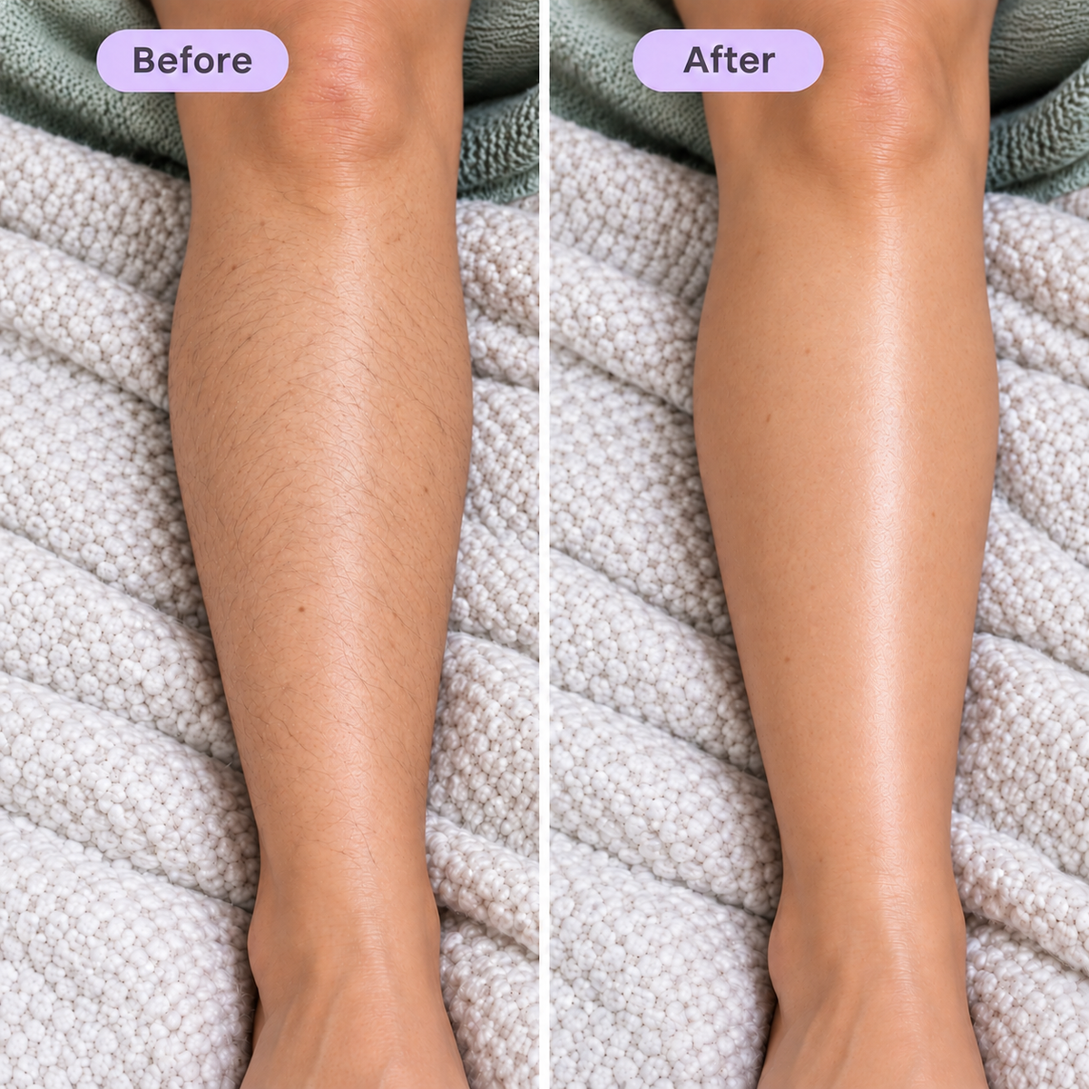 Balmo Hair - Removal Cream