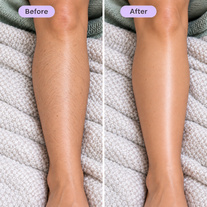 Balmo Hair - Removal Cream